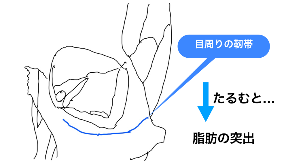 茶クマが出来るメカニズム