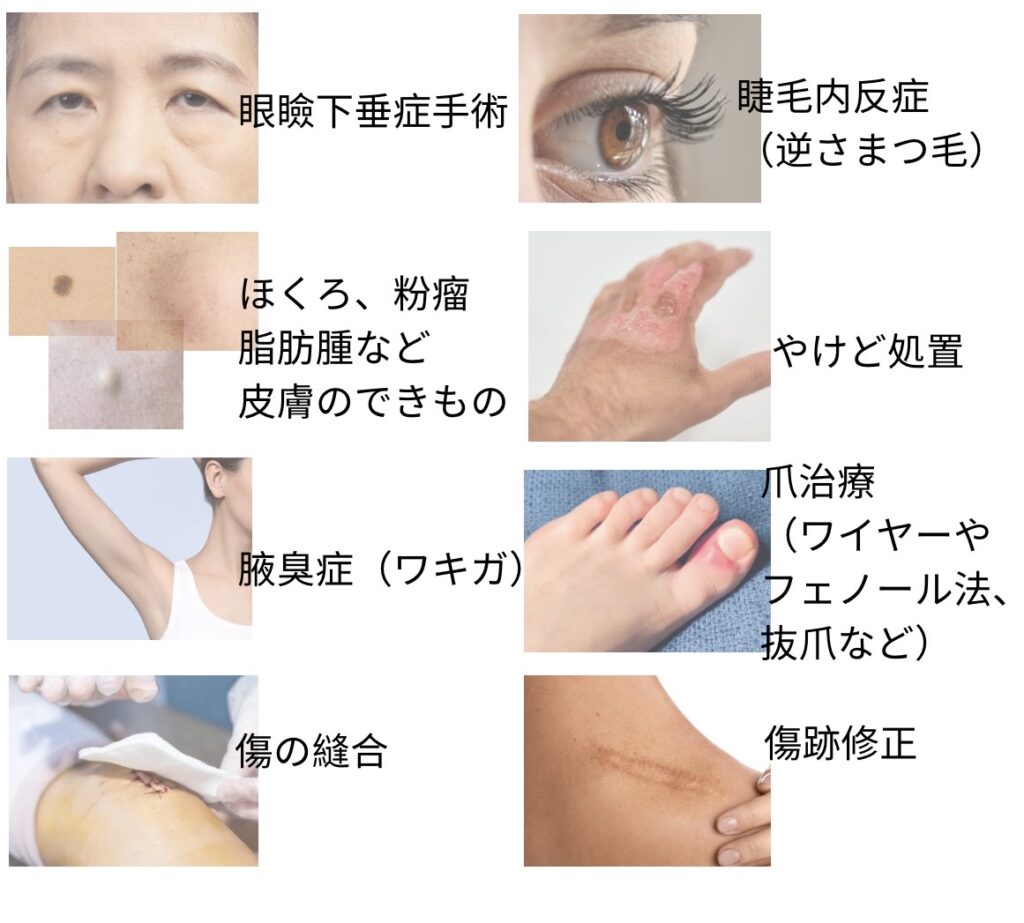 下北沢スキンクリニックで診察可能な形成外科疾患について説明した画像