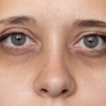 クマ治療(総論)