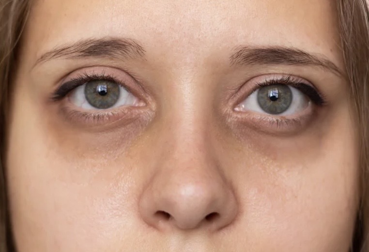 クマ治療(総論)