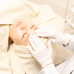 ケミカルピーリング