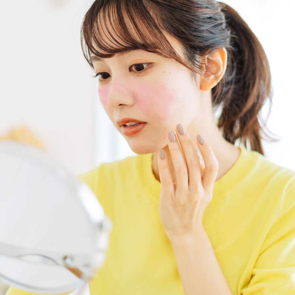 酒さ顔の女性のイメージ
