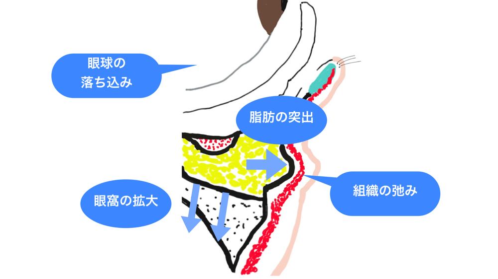 茶クマが出来るメカニズム