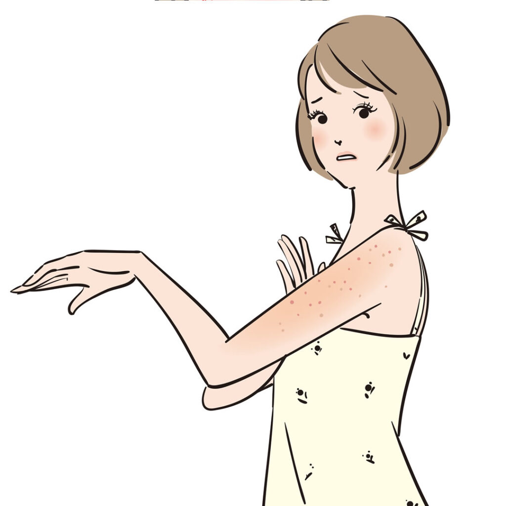 とびひに悩む女性のイメージ