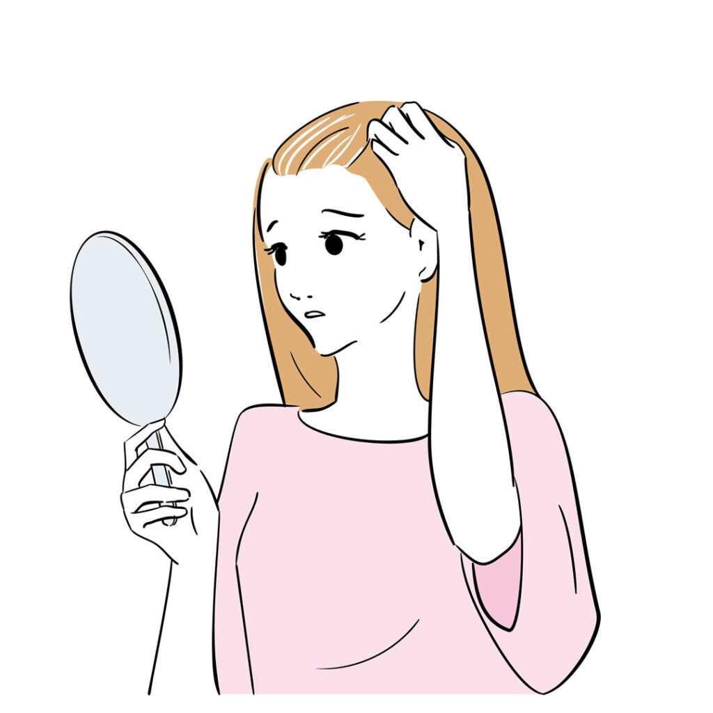 脱毛症に悩む女性のイメージ