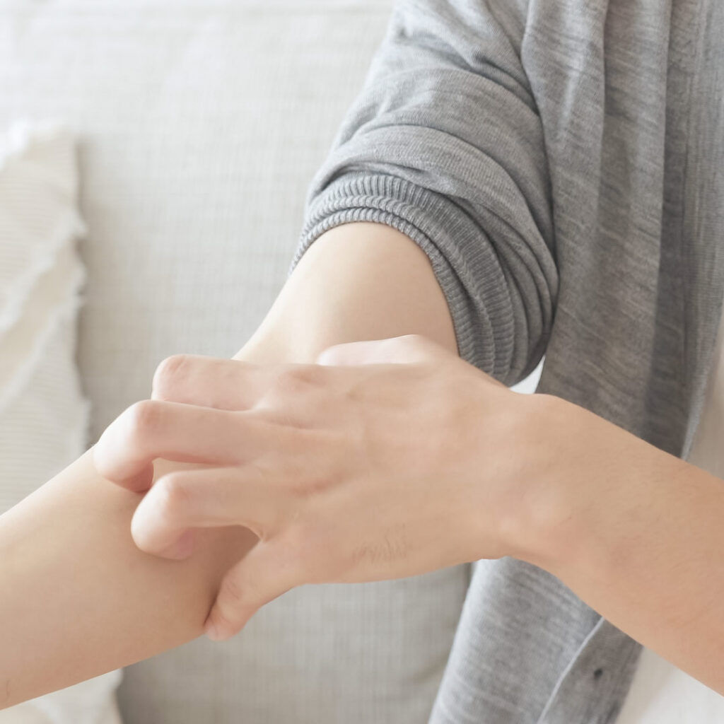 アトピーで腕をかいている女性
