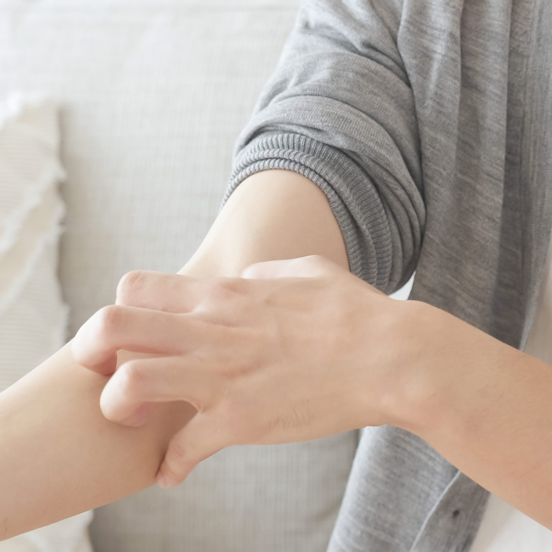 アトピーで腕をかいている女性
