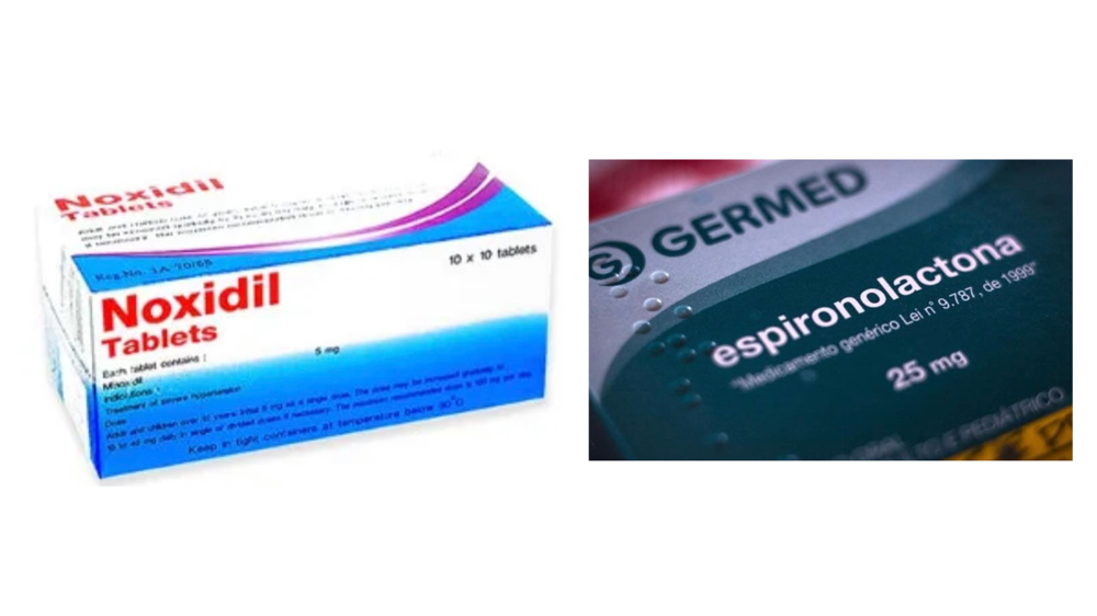 FAGAに対する飲み薬、スピロノラクトンとミノキシジル