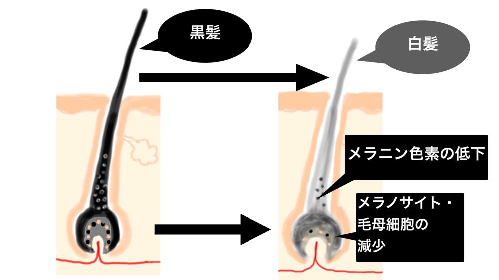 毛髪の加齢性変化について