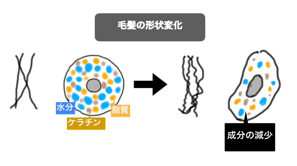 毛髪の加齢性変化について