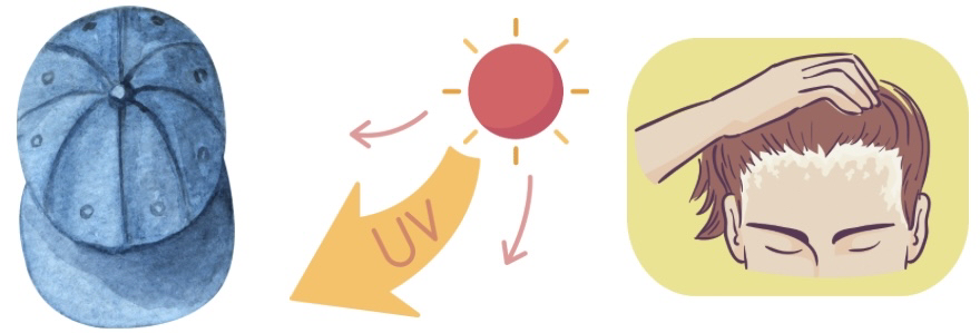 FAGA治療として、物理的な原因を取り除く
