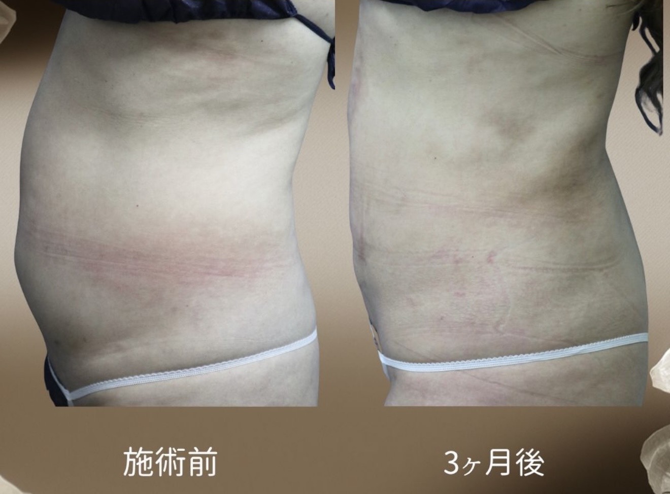 症例写真