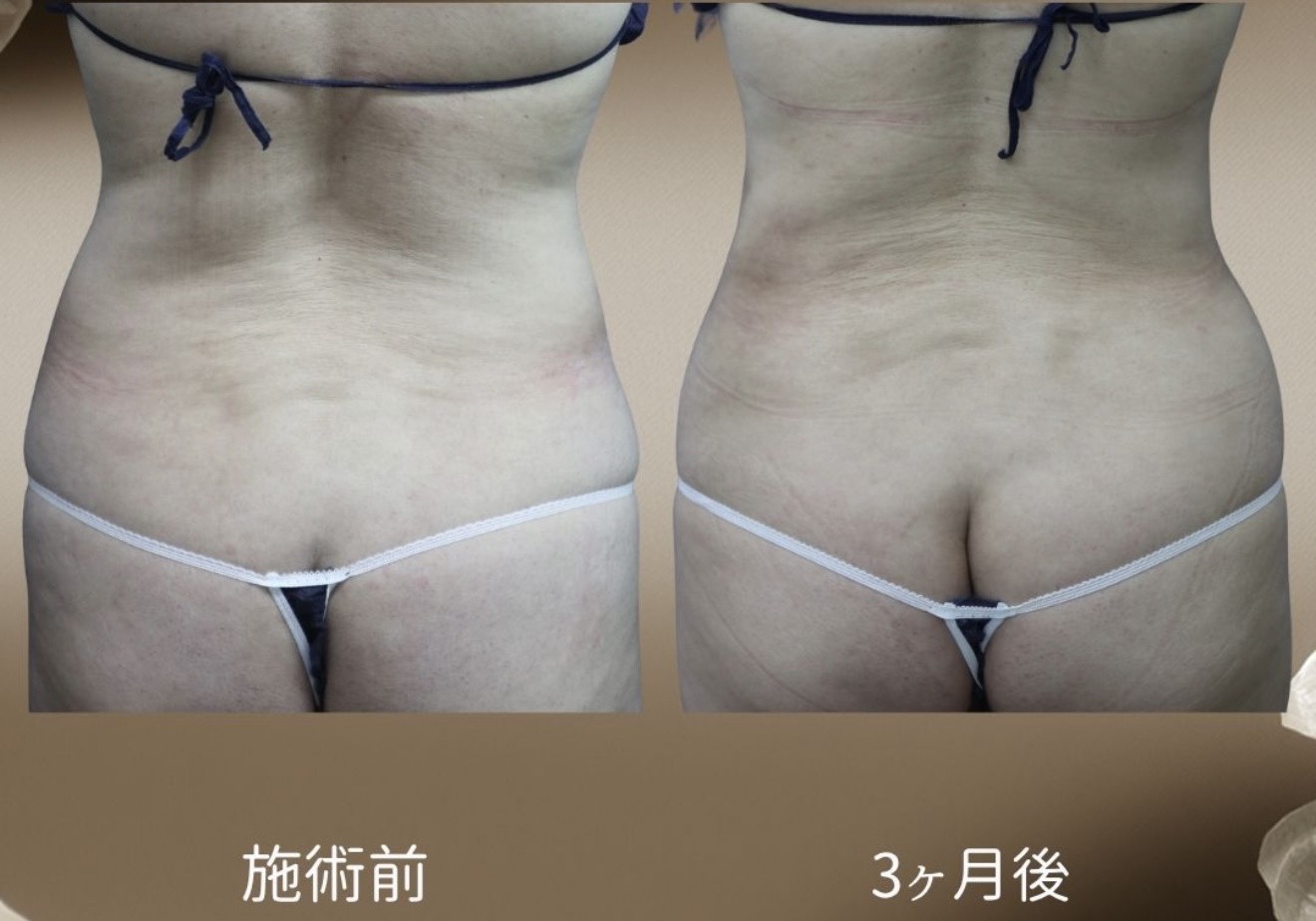 症例写真