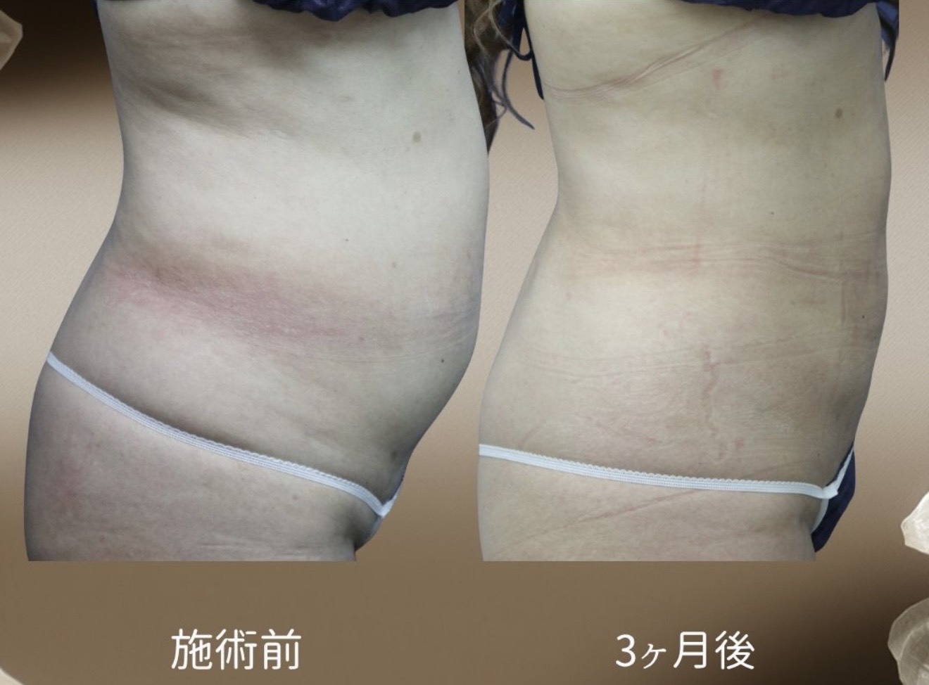 症例写真