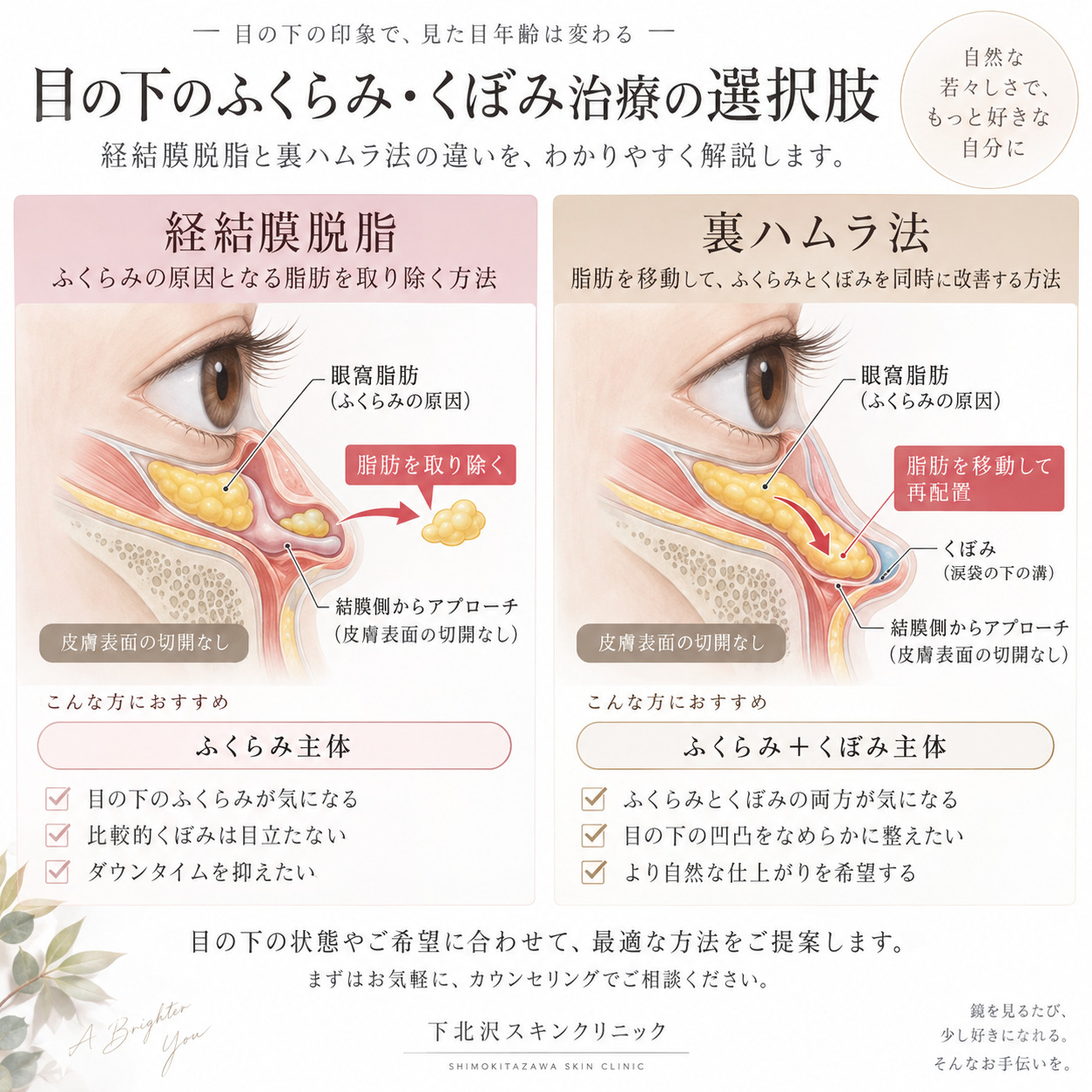 経結膜脱脂と裏ハムラ法の違いを示した比較図