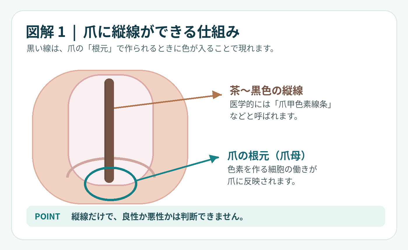 爪の根元の爪母で生じる色素が爪に縦線として現れる仕組みの模式図